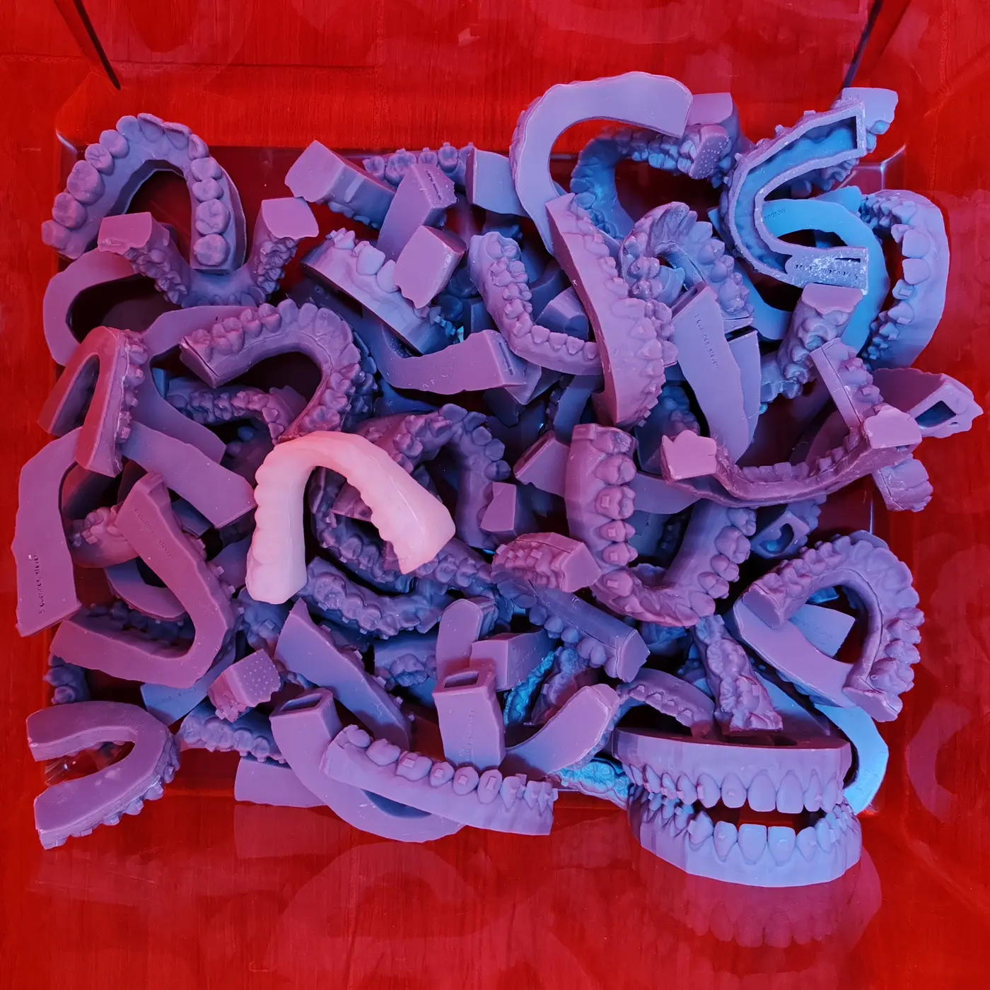 Modèles dentaires imprimés en 3D et aligneur transparent, fabriqués au laboratoire du cabinet